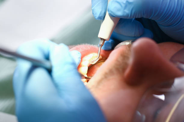 Best Emergency Dental Care for Trauma or Injury in Nottingham, PA
